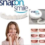 Snap On Smile – Dhëmbë të bardhë & perfektë në sekonda!
